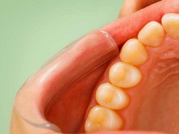 Was Ernährung wirklich für Ihre Zähne tun kann – und was nur ein Mythos ist
